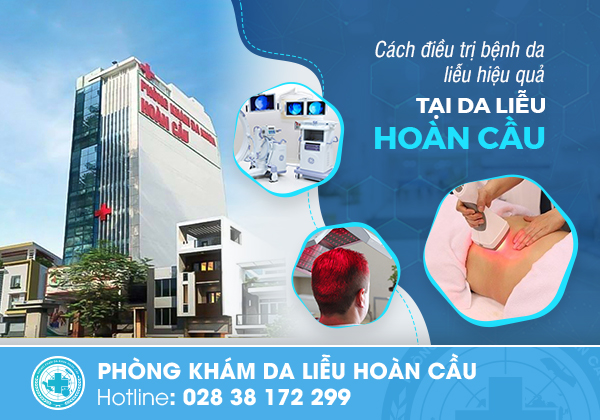 Phòng Khám Da Liễu Hoàn Cầu - Địa Chỉ điều trị hiệu tay nổi mụn nước tại TPHCM